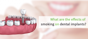 What are the effects of smoking on dental implants