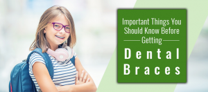Important Things You Should Know Before Getting Dental Braces