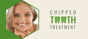 Chipped Tooth Treatment