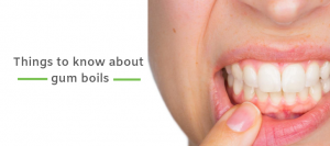 Things to know about gum boils