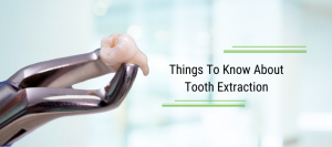 Things To Know About Tooth Extraction