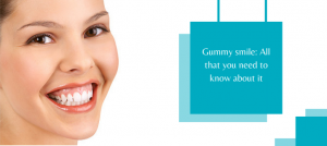 Gummy smile: All that you need to know about it