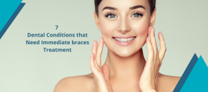 7 Dental Conditions that Need Immediate braces Treatment