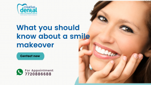 you should know about a smile makeover