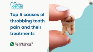 Top 5 causes of throbbing tooth pain and their treatments