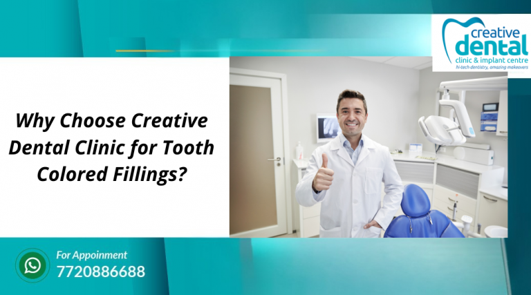 Why Choose Creative Dental Clinic for Tooth Colored Fillings?