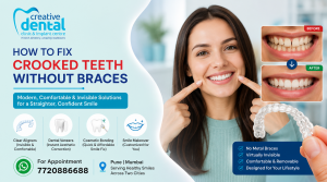 How to Fix Crooked Teeth Without Braces