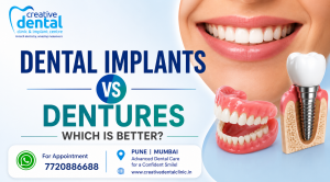 Dental Implants vs Dentures – Which Is Better