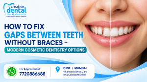 How to Fix Gaps Between Teeth Without Braces – Modern Cosmetic Dentistry Options How to Fix Gaps Between Teeth Without Braces – Modern Cosmetic Dentistry Options